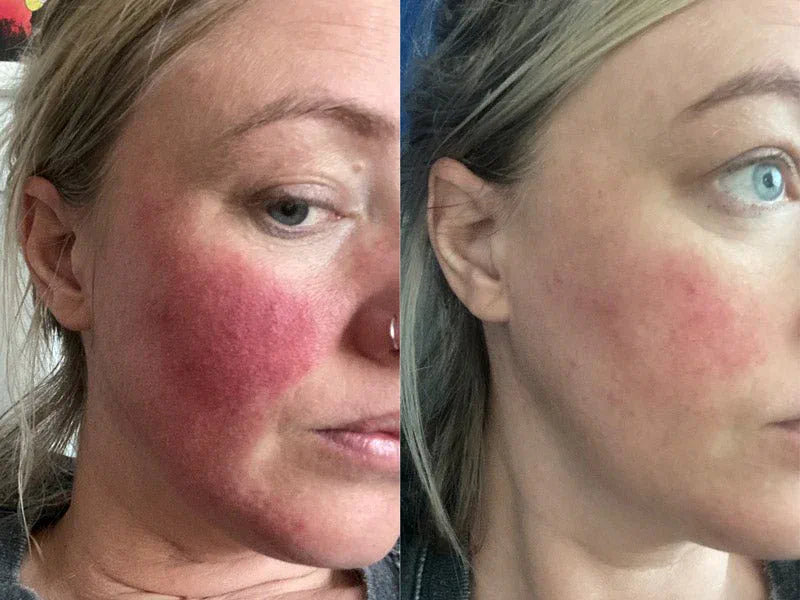 Jessica, 33 before and after