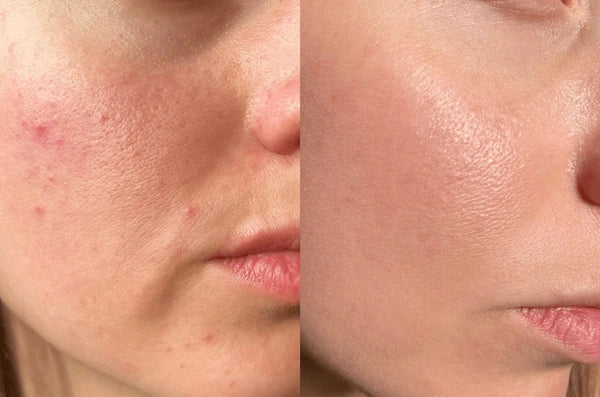 Jess, 24 before and after