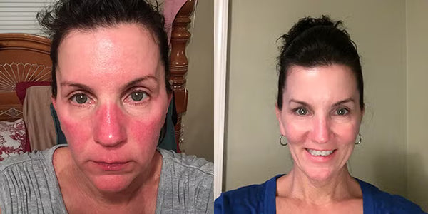 Angela, 39 before and after