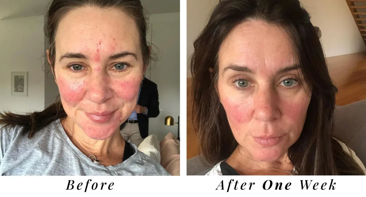 Olivia, 25 before and after