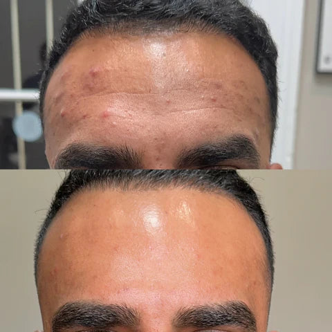 Chandler, 26 before and after