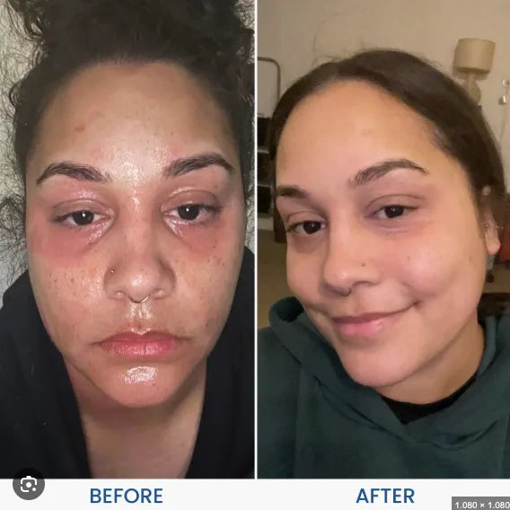 Michelle, 27 before and after