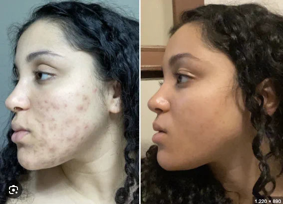 Sye, 28 before and after