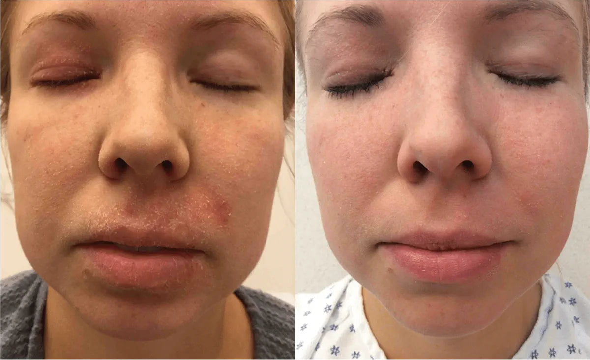 Zulaidia, 31 before and after