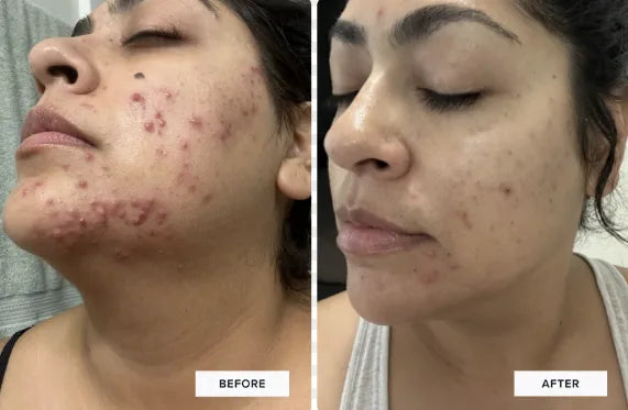 Zulidia, 31 before and after